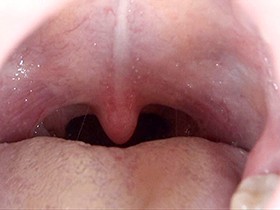 300人のおくち 第1集　サンプル画像02